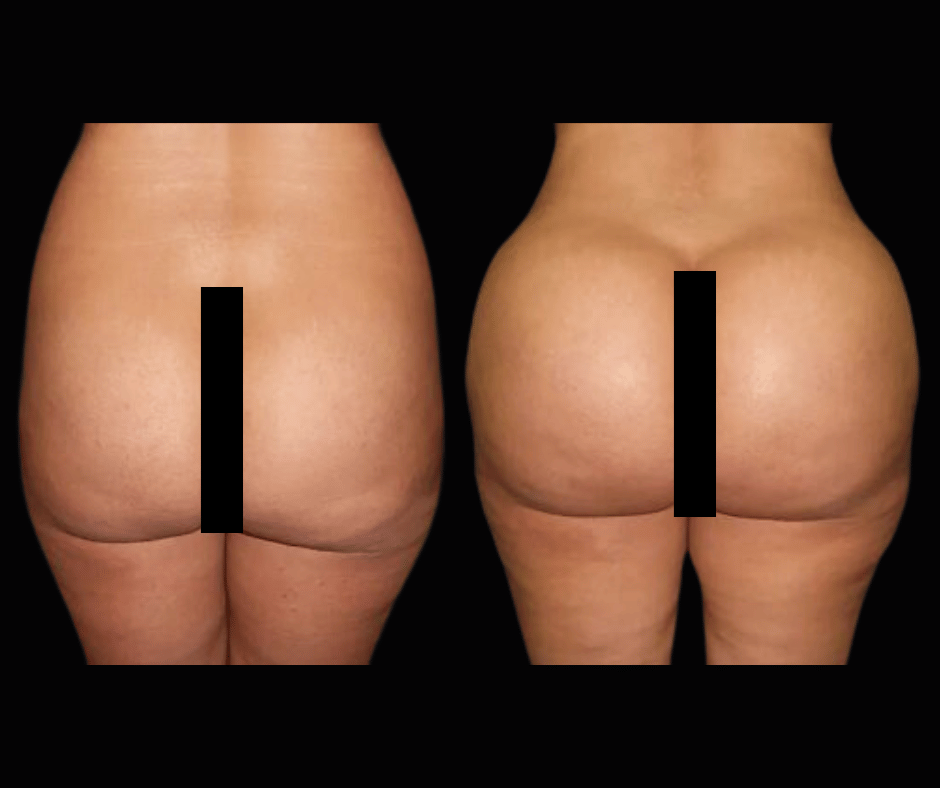 BBL Results Dr. Greenberg 6