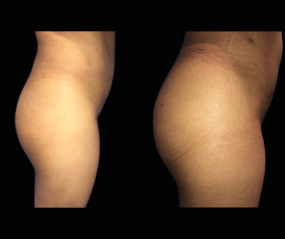 BBL Results Dr. Greenberg 4