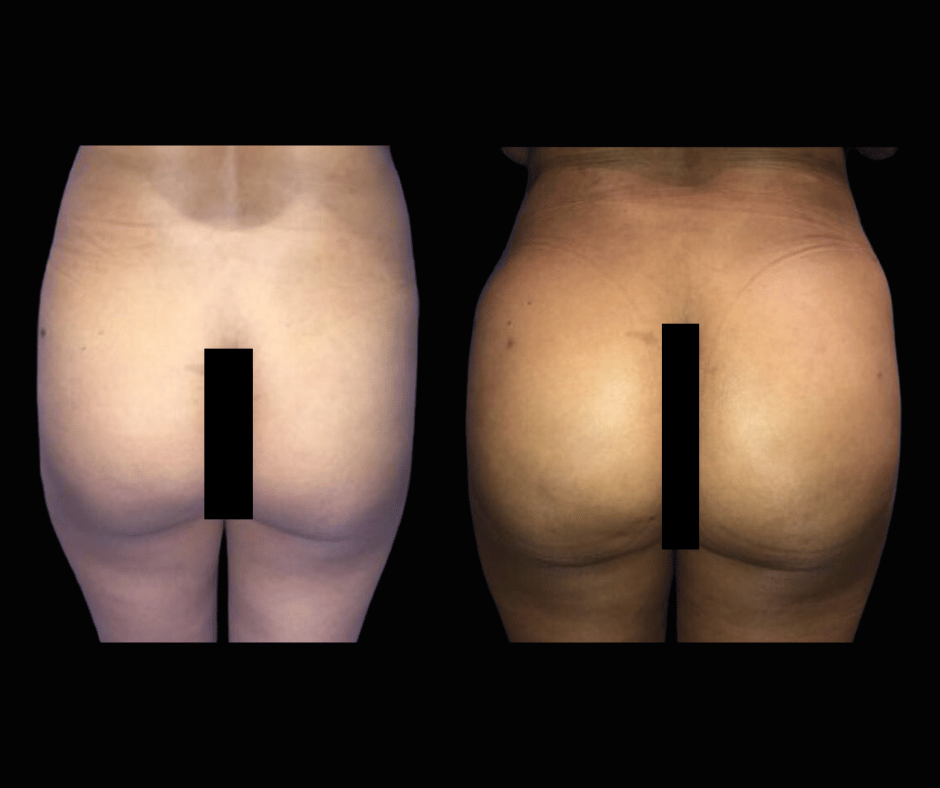 BBL Results Dr. Greenberg 1