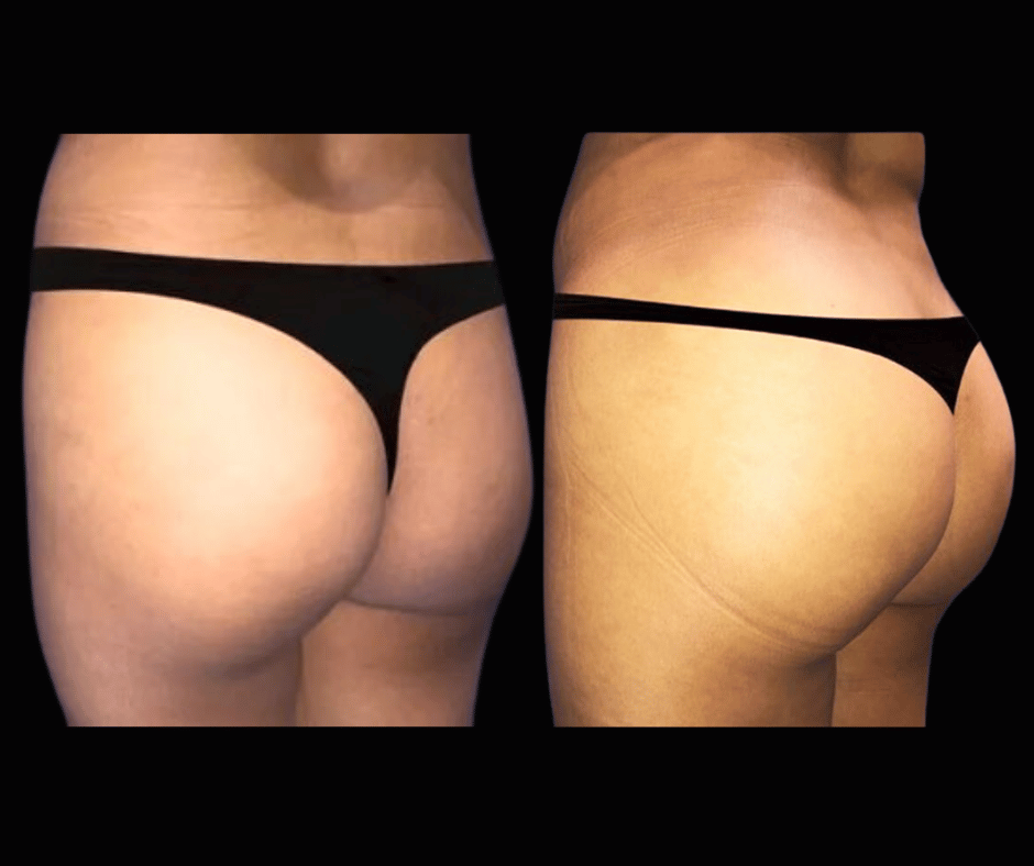 BBL Results Dr. Greenberg